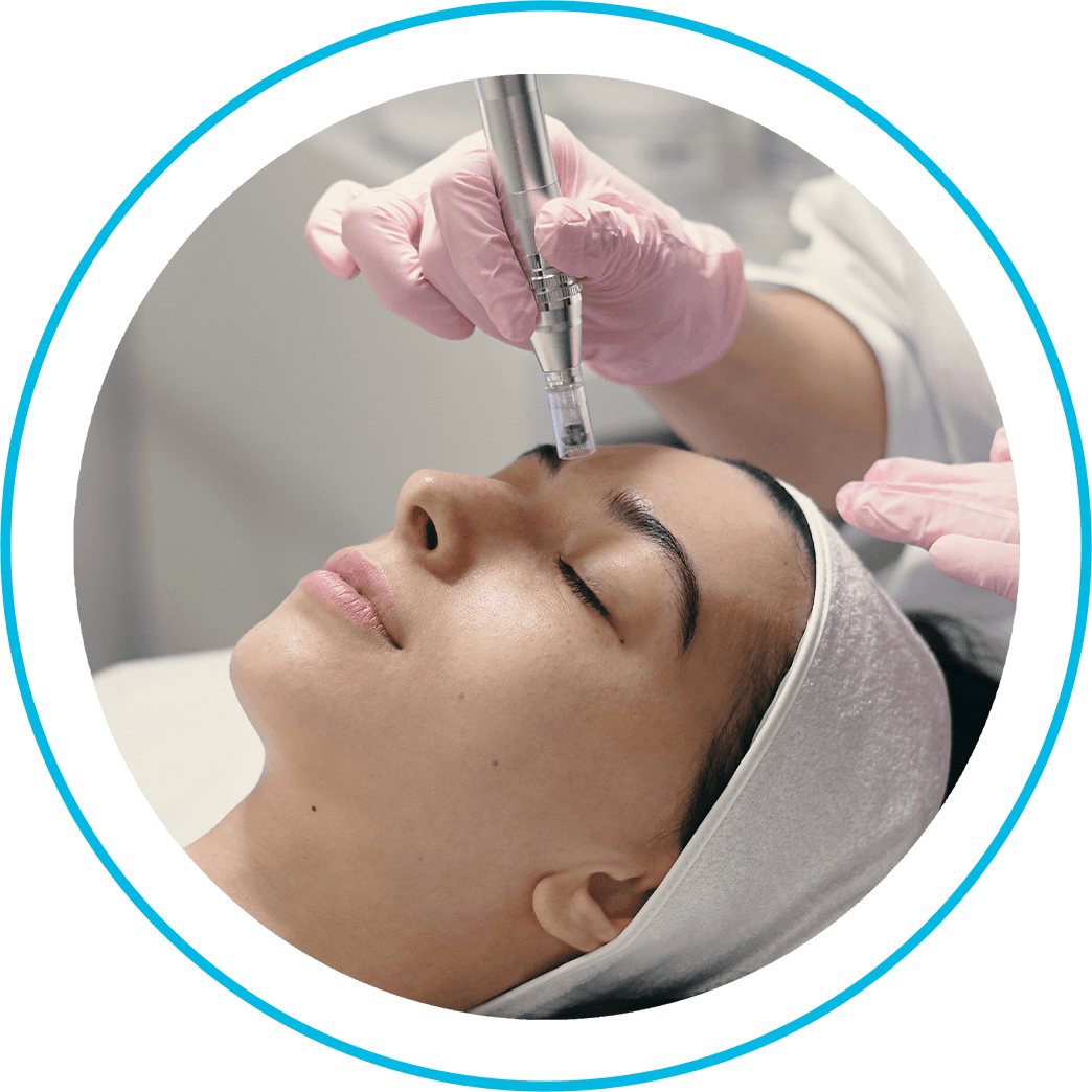 Automatic Microneedle Therapy